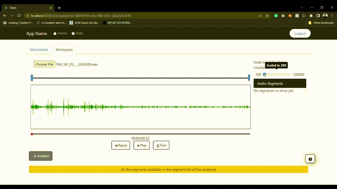 Pulmonary Disease Prediction